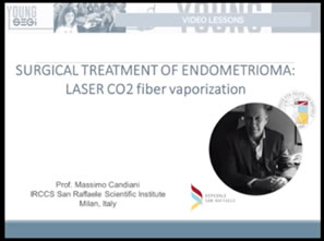 trattamento Laser CO2 dell'endometrioma